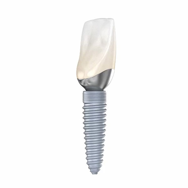 a dental implant